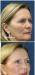 Skindalgece  испытанное оружие молодости превью 1413705.