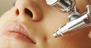 Ботокс, лантокс, диспорт.  Избавься от морщин Москва