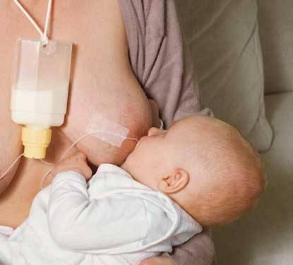 Дополнительная система кормления Medela Санкт-Петербург