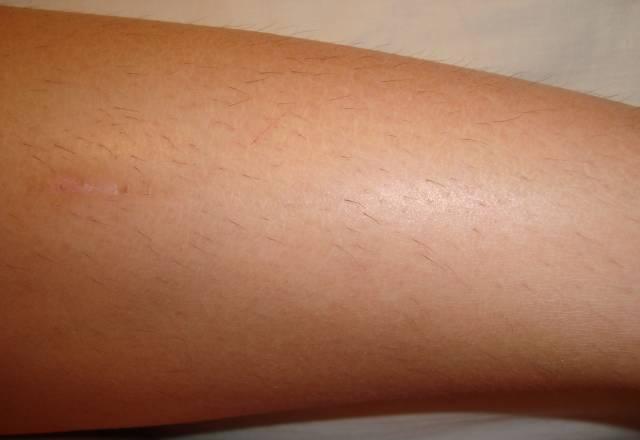 Депиляция теплым и горячим воском Уфа