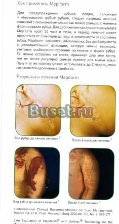 Пластырь Mepiform Москва