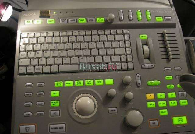 Аппарат узи бу Самара