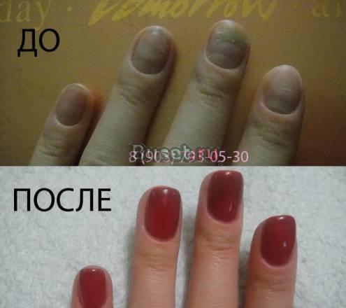 Укрепление ногтей биогелем Москва