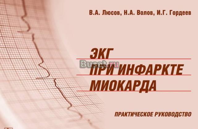 Атлас Экг при инфаркте миокарда Москва