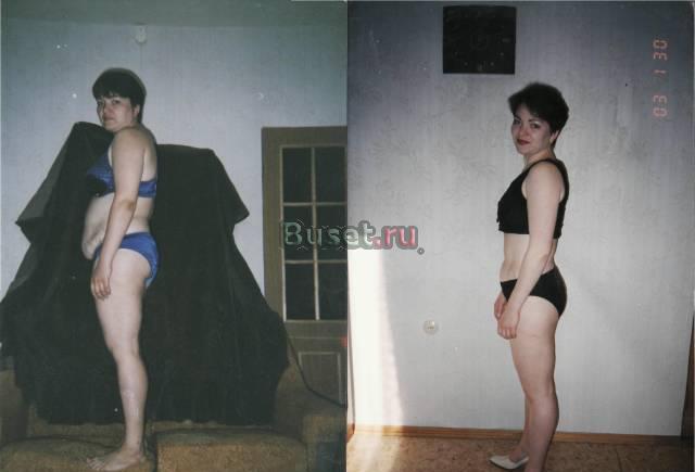 Ручная Липокоррекции Фигуры. ЛипоЭнергоПластика Москва