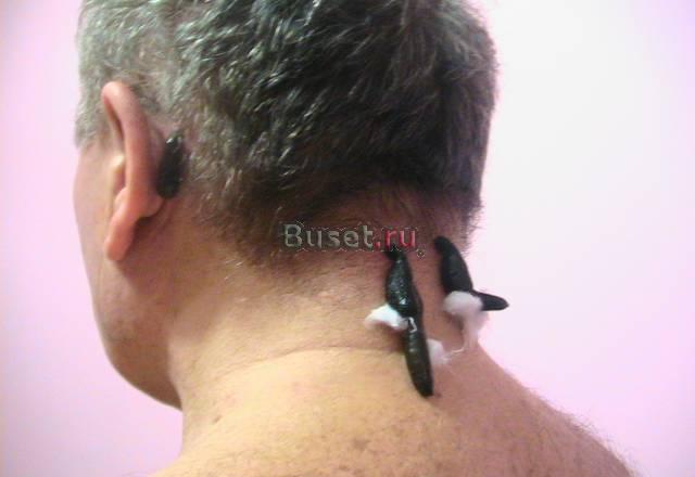 Пиявка медицинская оптом Омск