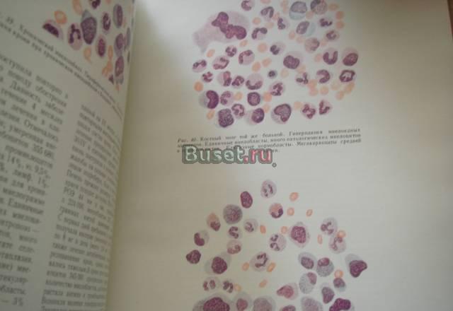 Клинико-гематологический  атлас  формата  А4   под Москва