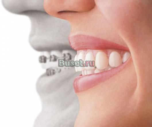 Врач-ортодонт Исправление прикуса  любом возрасте Рязань