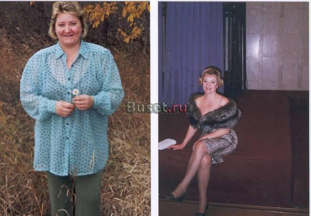 Элитное похудение и коррекция фигуры Москва