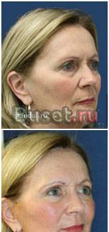 Скиндалженс-переворот в косметологии Санкт-Петербург