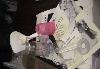 Превью Молокоотсос "Мой малыш" Санкт-Петербург - 1