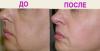 Превью Skindalgece  испытанное оружие молодости Санкт-Петербург - 1