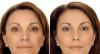 Превью Skindalgece  испытанное оружие молодости Санкт-Петербург - 2