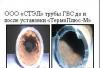 Превью Умягчитель воды. Tермоплюс-М. Защита от Накипи Москва - 1